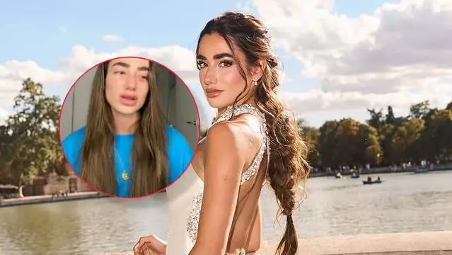 Lola Lolita deja las redes temporalmente para cuidarse